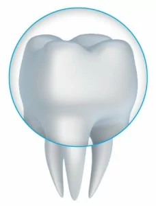 Dental Crown Diagram Arlington TX - Stephen Ratcliff Family & Cosmetic Dentistry