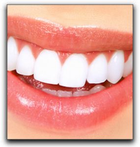 Close-up Photo Porcelain Dental Veneers Arlington TX