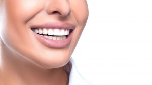 Porcelain Dental Veneers - Stephen Ratcliff Arlington TX Cosmetic Dentistry