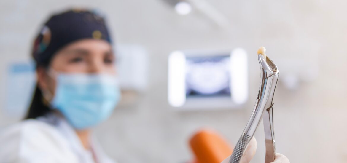 doctor pulling a tooth in Arlington